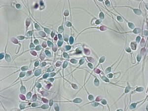 青色：頭部細胞膜正常精子