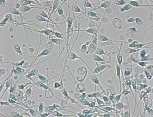 図4頭部空胞精子(空胞は染色されない)