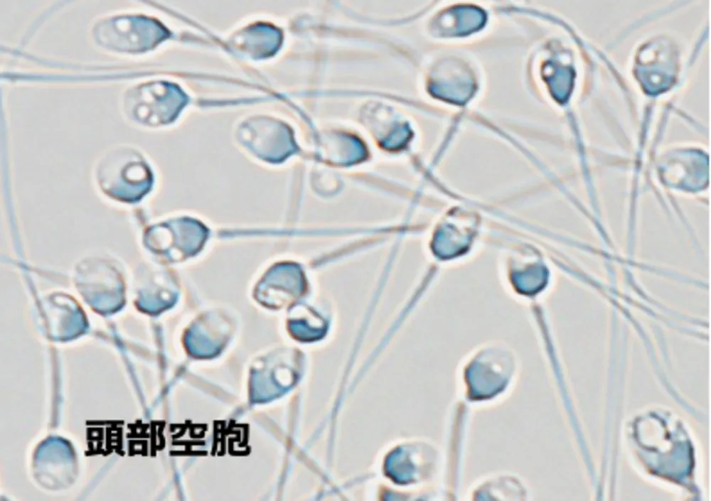 精子の頭部空胞の画像