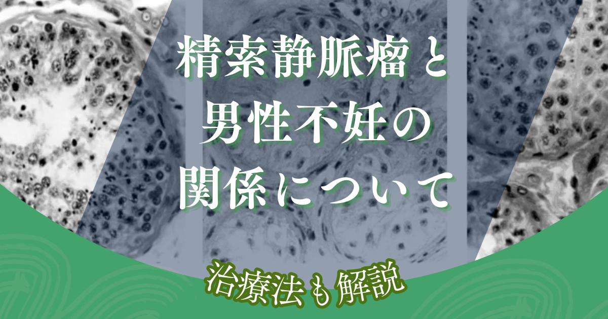 【不妊治療】精索静脈瘤と男性不妊の関係について＿治療法解説