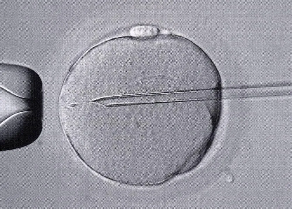 顕微授精の画像