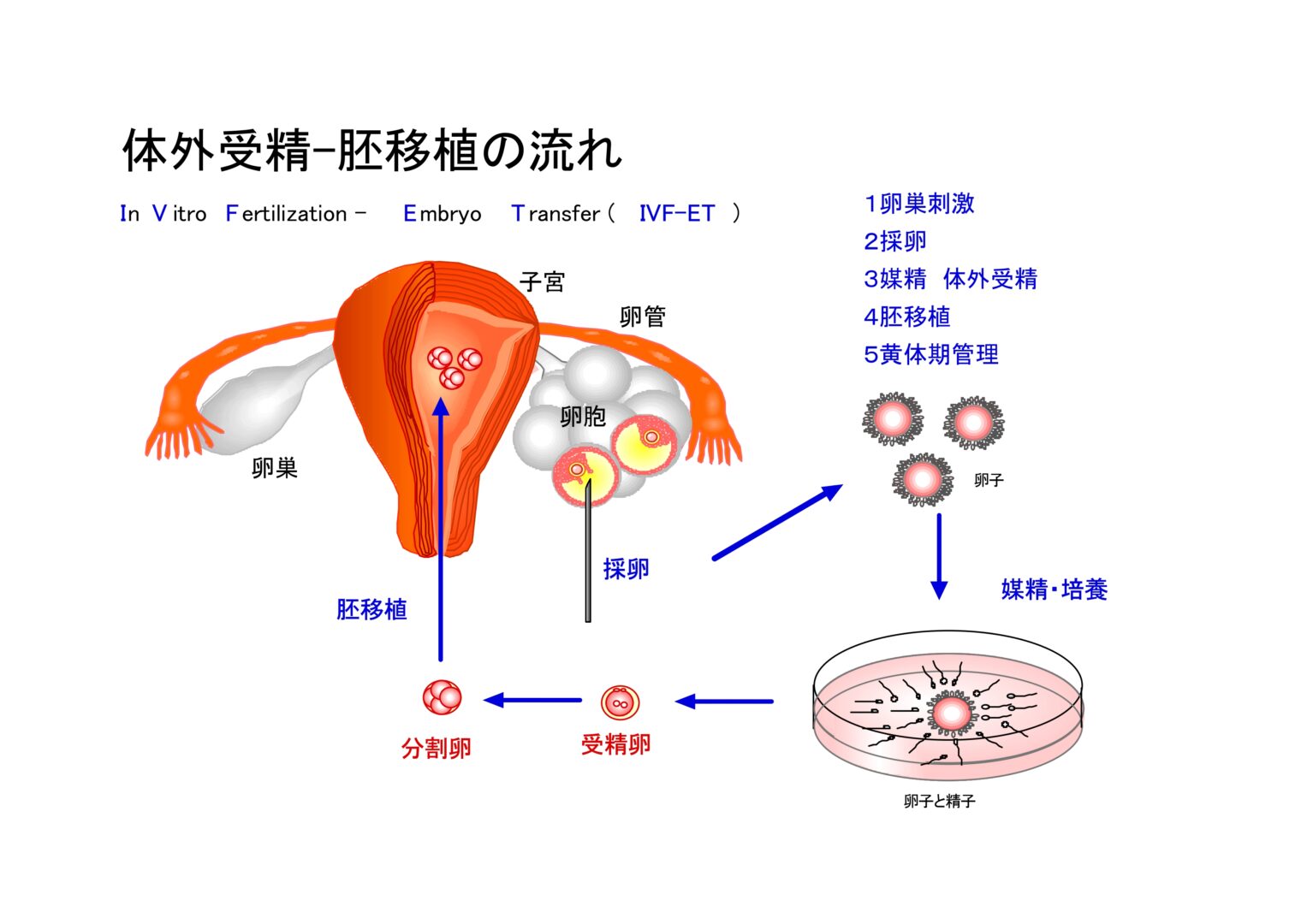 体外受精-胚移植の流れの画像