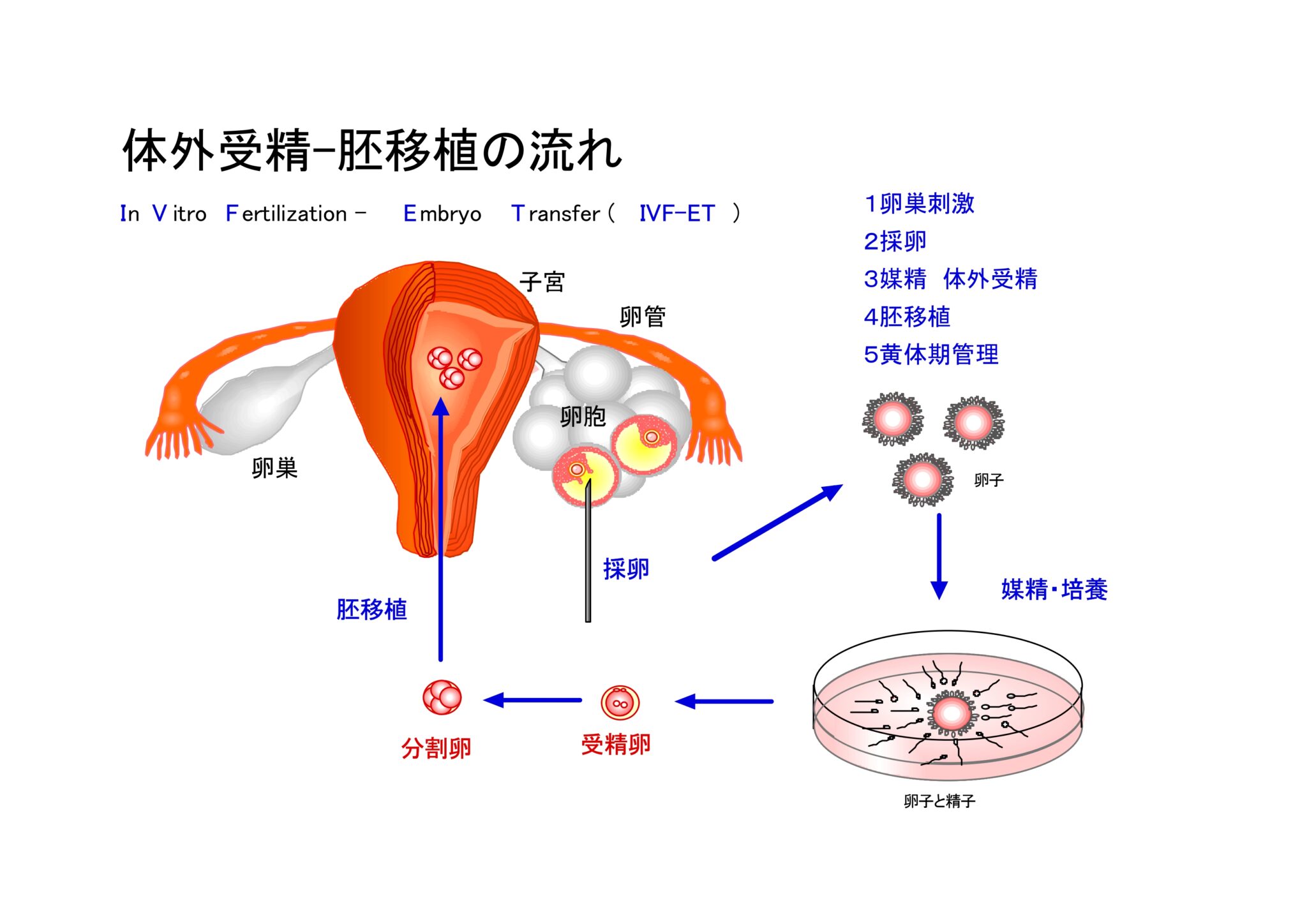 体外受精と人工授精の違いは?専門医が図解を使って詳しく解説 - 【不妊治療】男性不妊専門クリニック黒田IMR