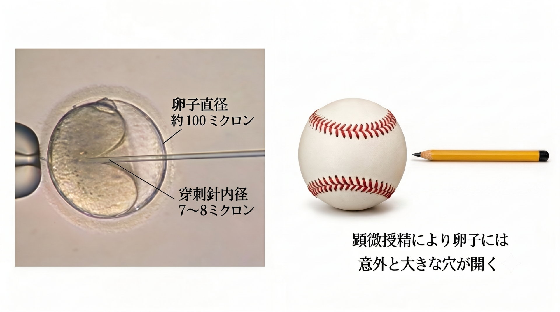 顕微授精の際卵子には意外と大きい穴が開く