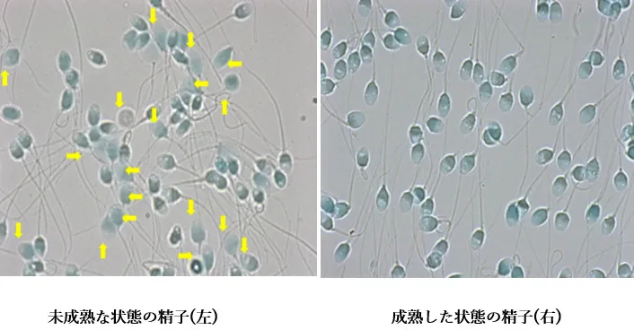 成熟、未成熟な精子の画像