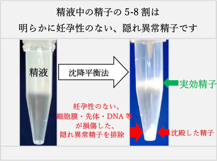 精子と精液の違いは？ 新しい高精度な精子検査と現行の精液検査の違いについても解説 | 黒田インターナショナルメディカルリプロダクション