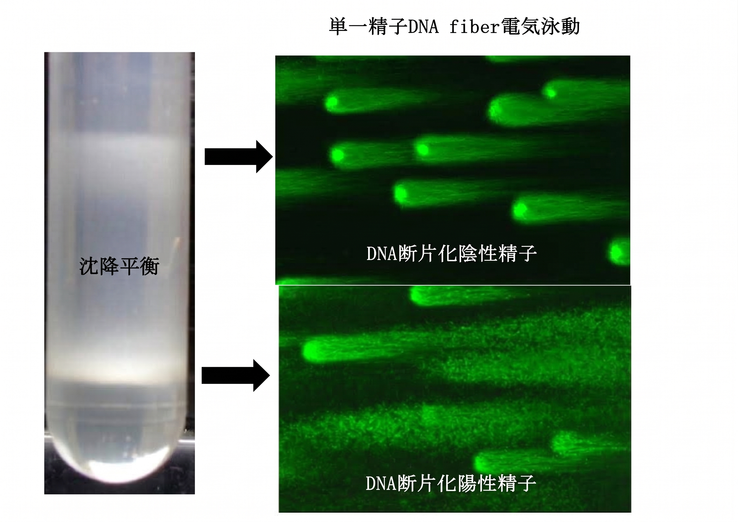 精子のDNA断片化