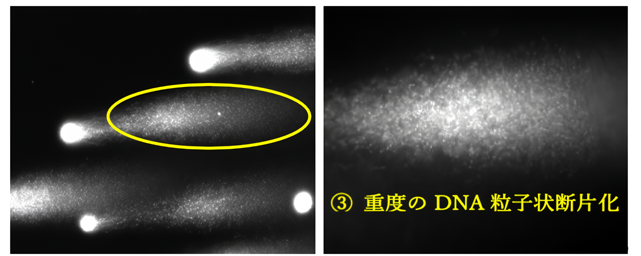 重度DNA断片化陽性精子