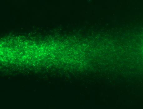 重度DNA断片化陽性精子の更に拡大した蛍光写真